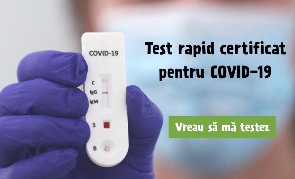 test COVID19