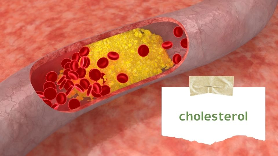 Trápí mě: Cholesterol