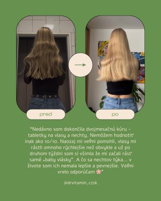 Pozitívna recenzia našej zákazníčky Niny❗️😍 #health #supplements #doplnkystravy