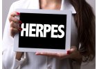 Herpes