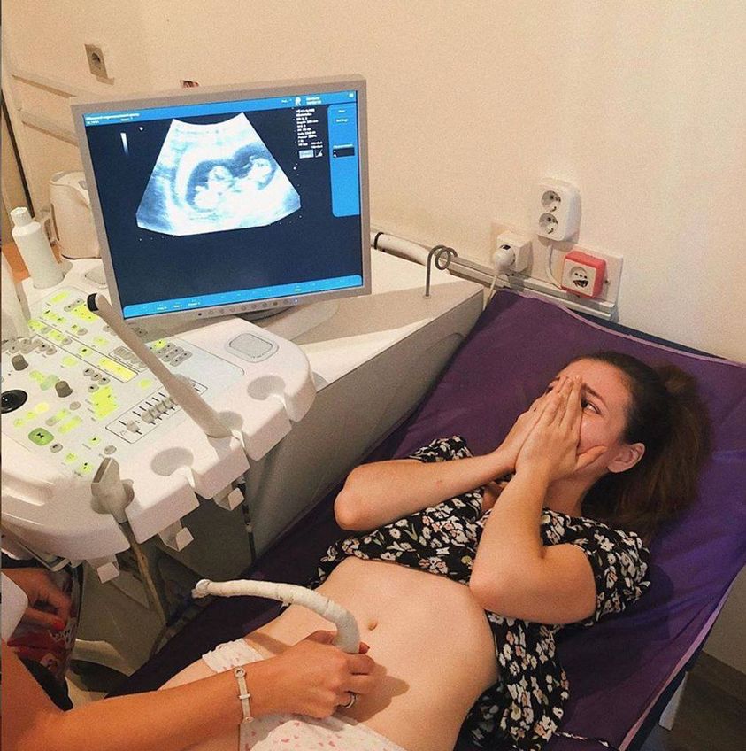 Ultrazvuková vyšetření vícečetného těhotenství