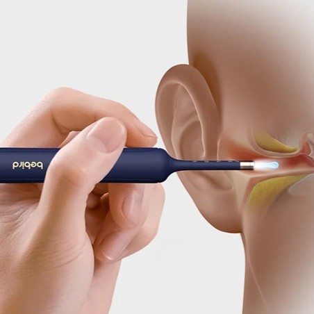 Bebird EarSight Plus Barva: Bílá (obrázek 6)