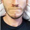 Lunesto Mouth Tapes pásky na ústa 30 ks proti chrapání obličej