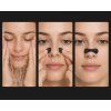 Sleep sport nasal dilator8