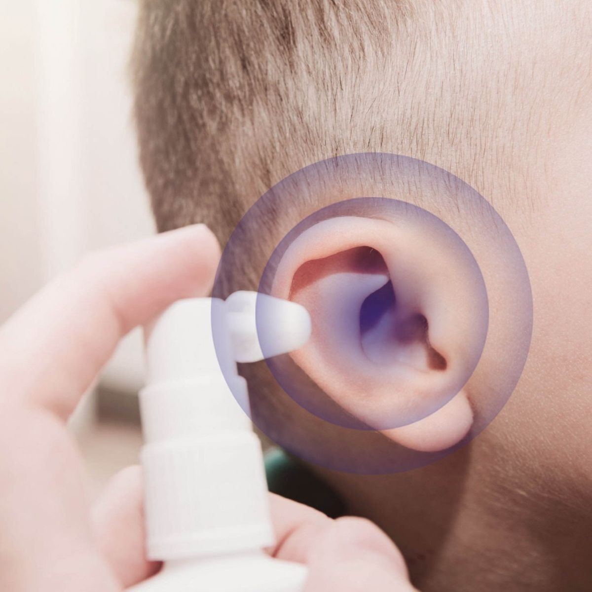 Zloženie ENEO Otic Solution na zmäkčenie mazu a upokojenie zvukovodu