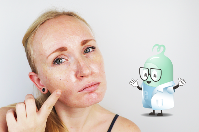 Odhaľte príčiny mastnej pleti. Vyskúšajte tipy, ktoré konečne zaberú