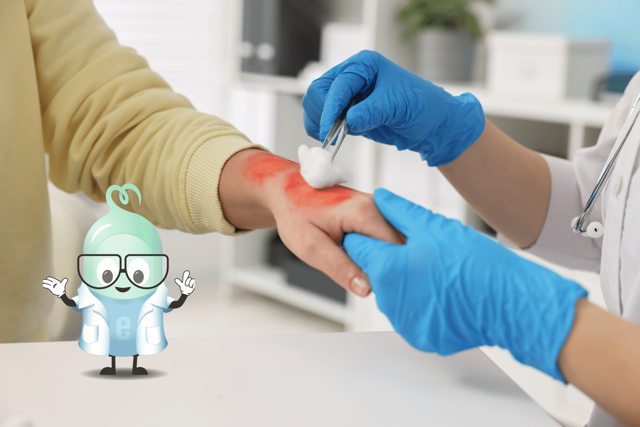 Čo na popáleniny? Urýchlite ich hojenie efektívne