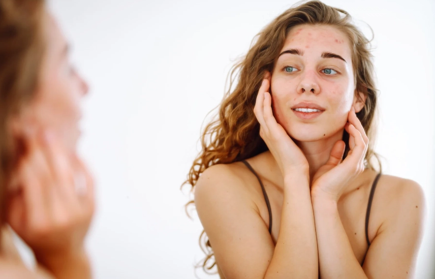 Suchá pokožka a zima: Ako sa brániť voči chladu a nízkej vlhkosti