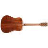 TANGLEWOOD TW15 R