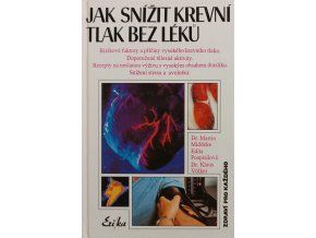 JK34 (6)