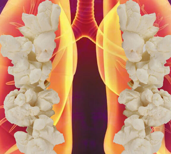 Mohou elektronické cigarety za onemocnění Popcornové Plíce?