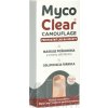Myco Clear Camouflage Priepustný lak na nechty - 1x5 ml