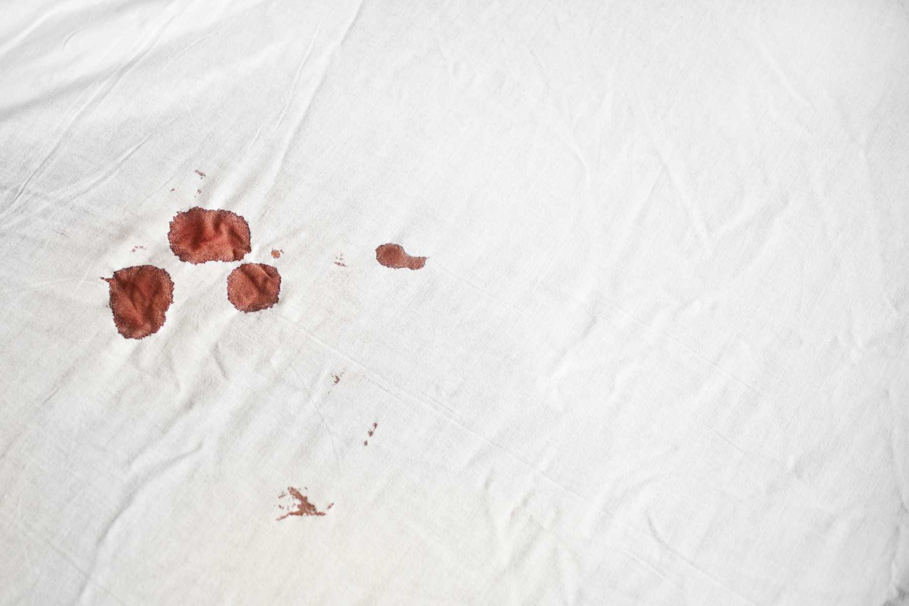 Útmutató: Hogyan távolítsuk el a vért az ágyneműből vagy lepedőkről?