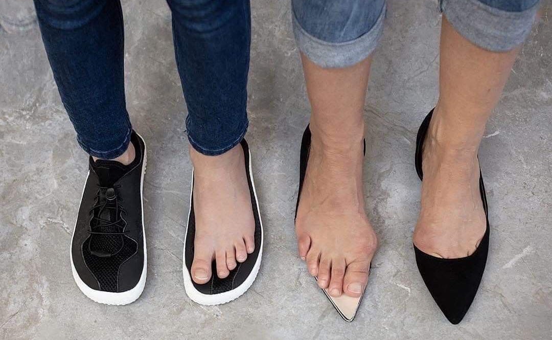 "Bola som milovníčka lodičiek… a teraz nosím barefoot. Prečo mám v skrinke oboje?"