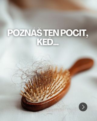 Zastav vypadávanie vlasov skôr, než bude neskoro 🛑 Vlasy sú zrkadlom nášho vnútorného zdravia. Ak ich nachádzaš všade, len...