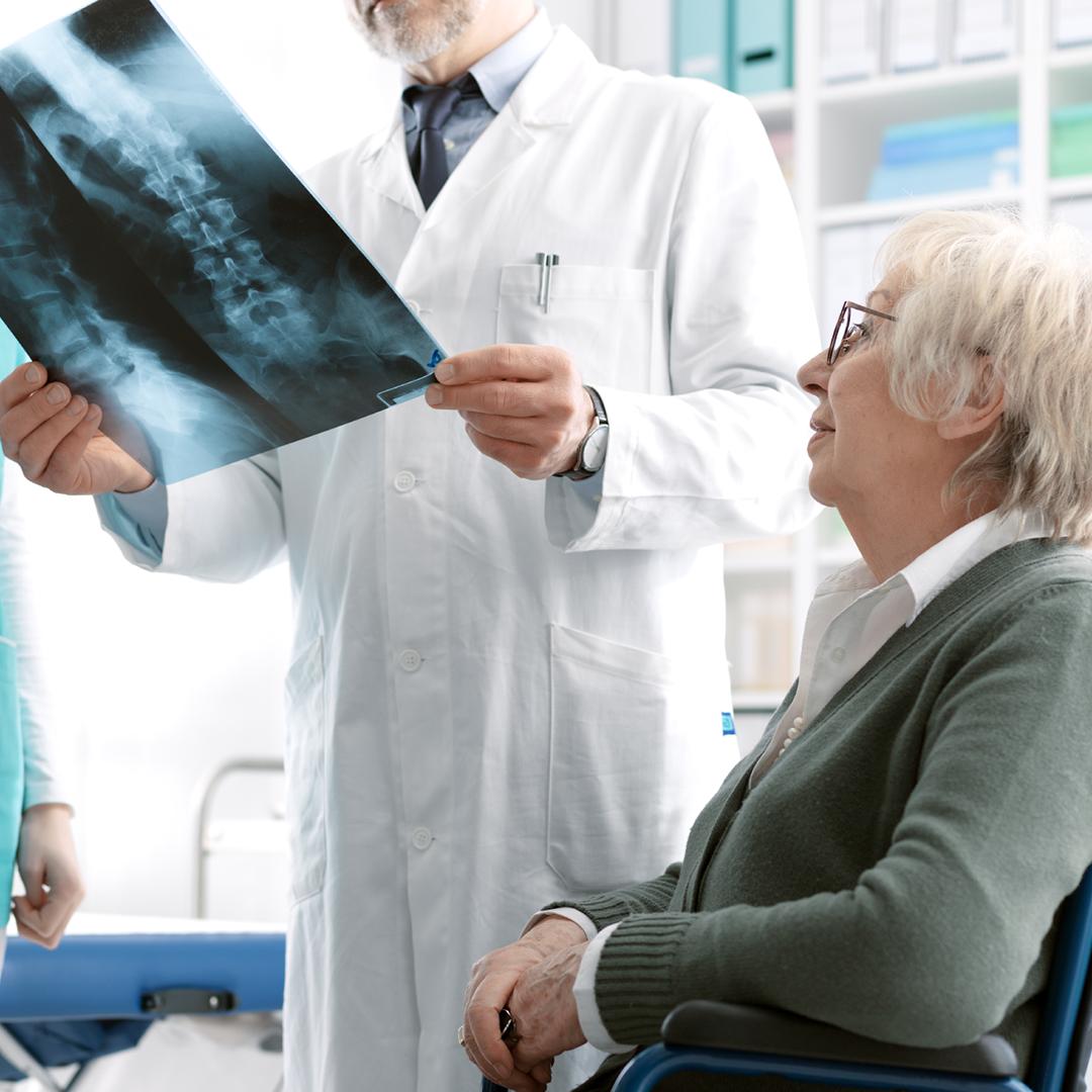 Osteoporóza: Príčiny a mechanizmy tvorby