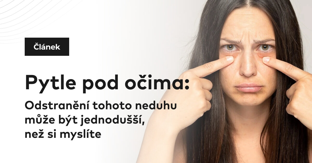 Pytle pod očima: Odstranění tohoto neduhu může být jednodušší, než si myslíte