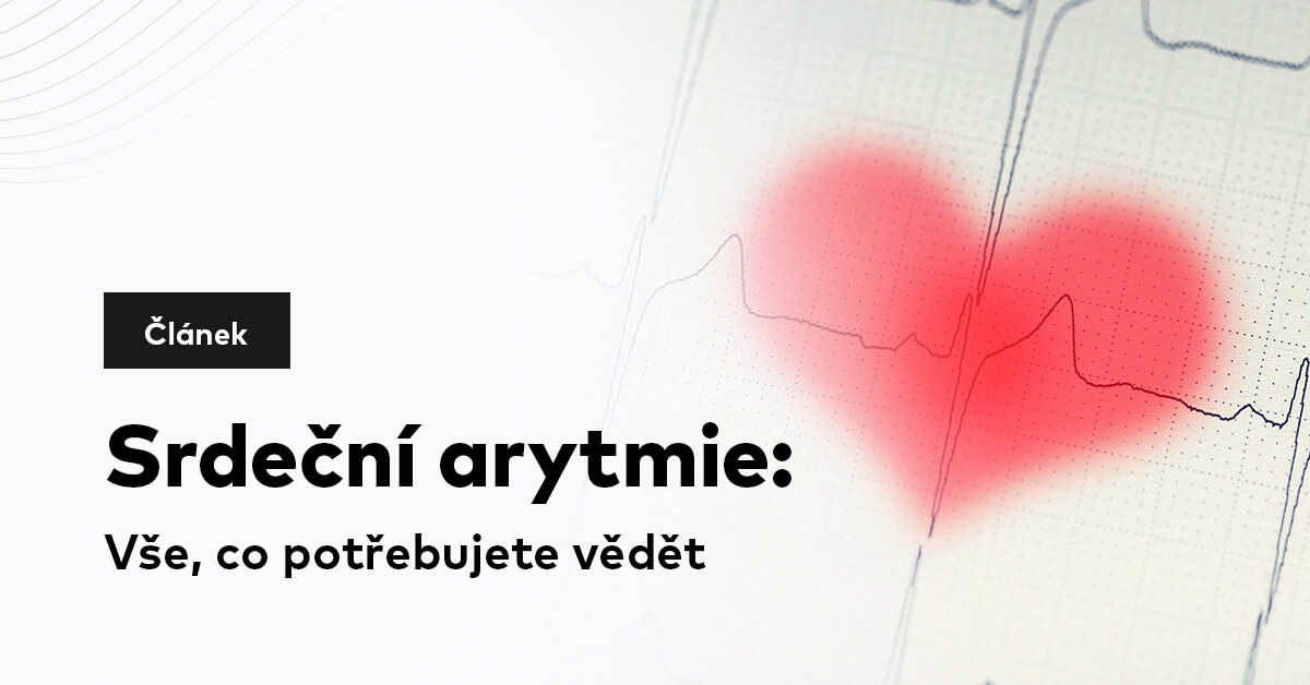 Srdeční arytmie: Vše, co potřebujete vědět
