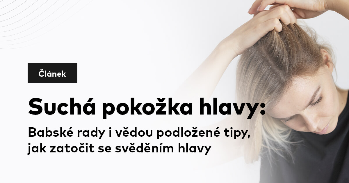 Suchá pokožka hlavy: Babské rady i vědou podložené tipy, jak zatočit se svěděním hlavy