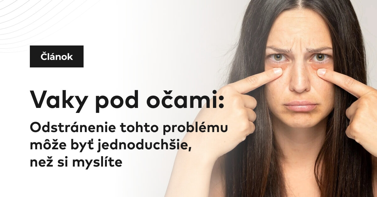 Vaky pod očami: Odstránenie tohto problému môže byť jednoduchšie, než si myslíte