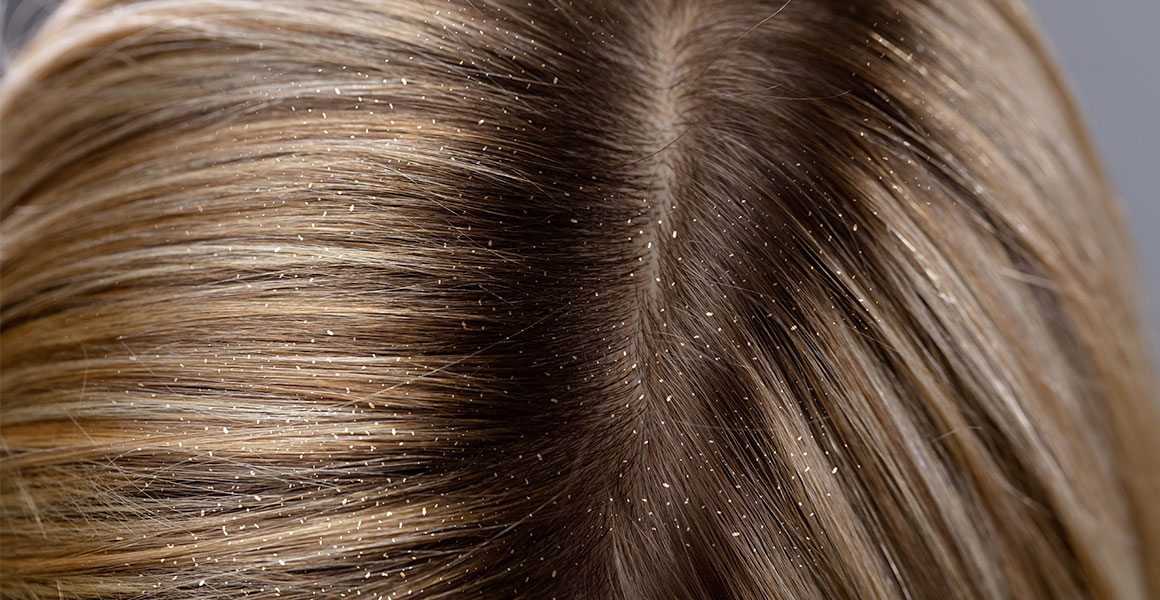 Víme vlastně, co jsou lupy?