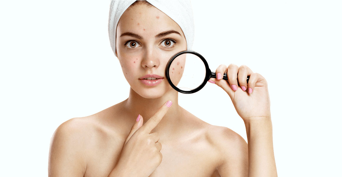 WIE WIRD MAN PICKEL LOS