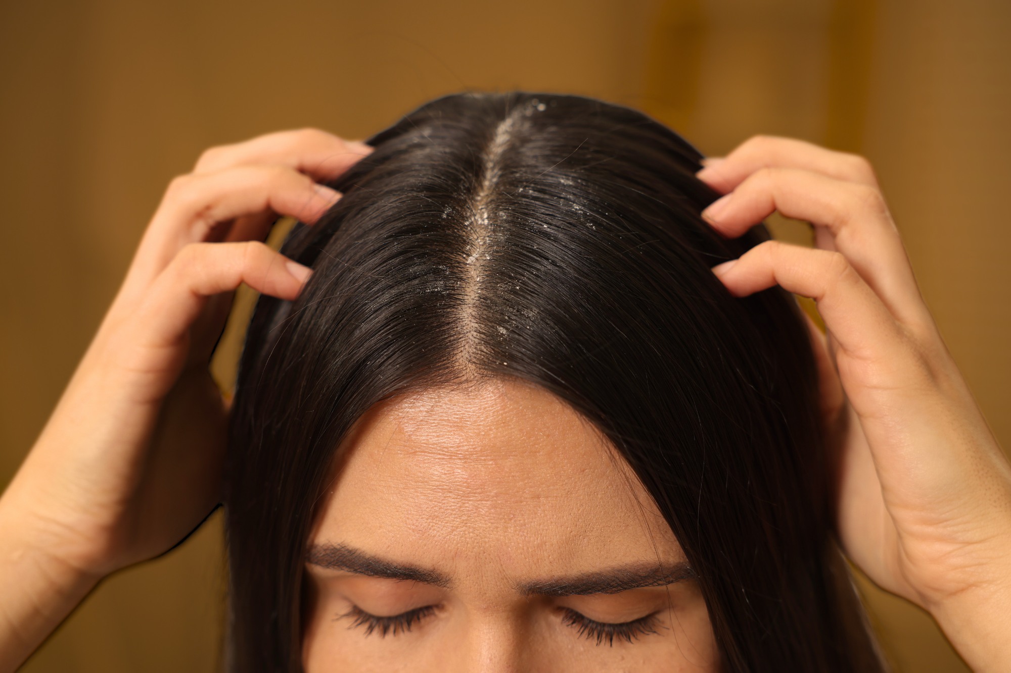 Lupy ve vlasech vás už trápit nemusí