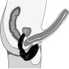 LOLO masažér prostaty a perinea s vibracemi