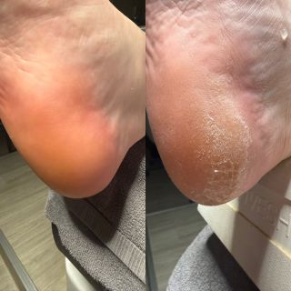 U nás si vybere každý ! PEDIKÚRA Spa Kart Suchá Kosmetická Medicinální Podologie
