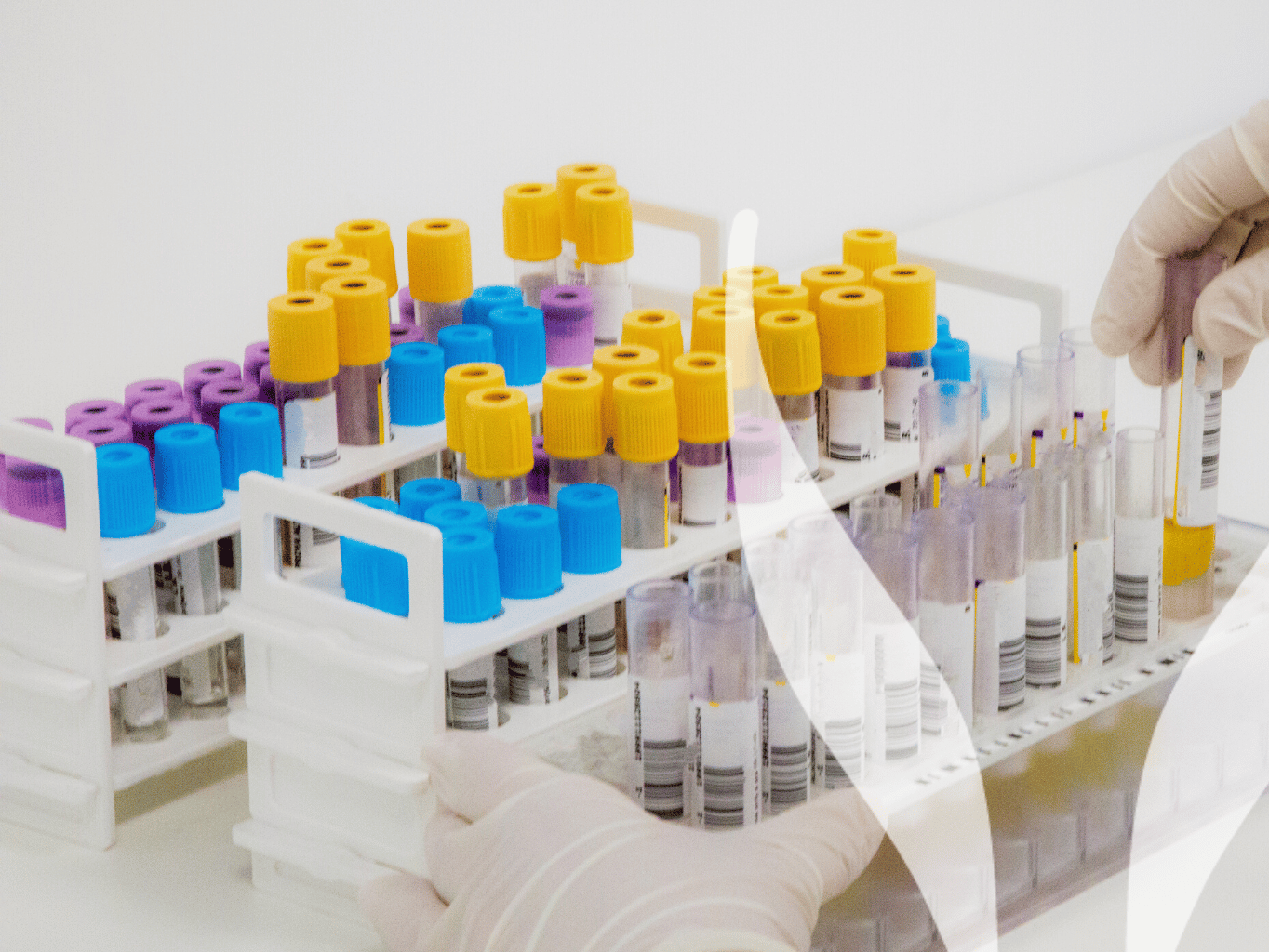 Odhalení skrytých příznaků: Jak laboratorní testy odhalují onemocnění jater a ledvin?