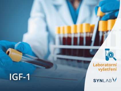 IGF 1 metoda vyšetření SYNLAB