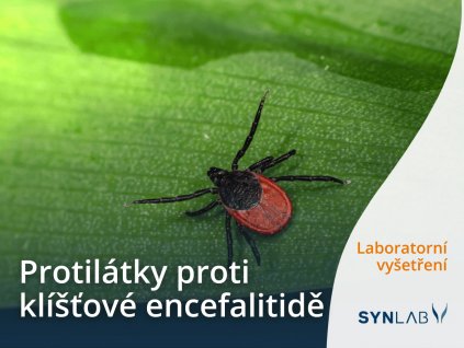 Test protilátek proti klíšťové encefalitidě Synlab