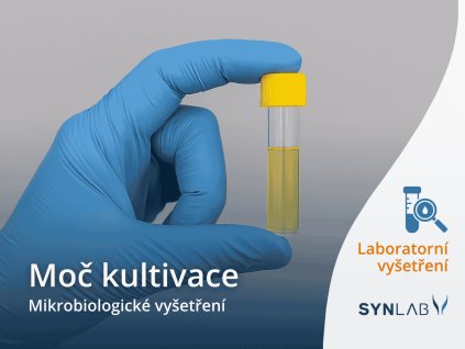 Mikrobiologické vyšetření moči SYNLAB