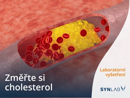 Laboratorní test hladiny cholesterolu Synlab