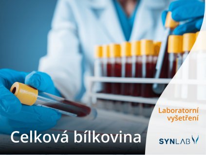 celkova bilkovina synlab