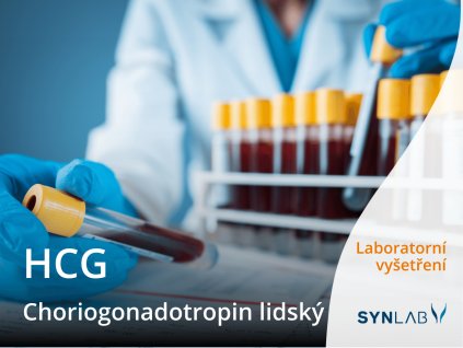 hcg choriogonadotropin synlab