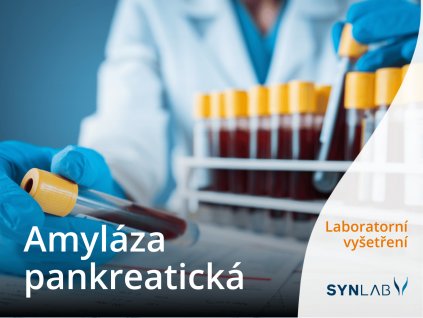 ams amylaza pankreaticka synlab