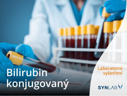 bilirubin konjugovany synlab