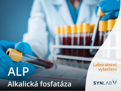 alp alkalicka fosfataza synlab