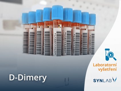D dimery test SYNLAB