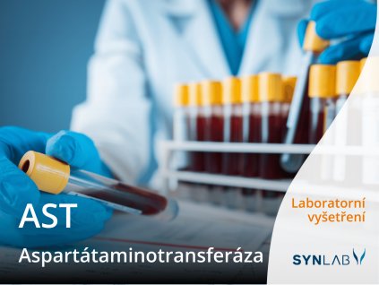 ast aspartataminotransferaza synlab