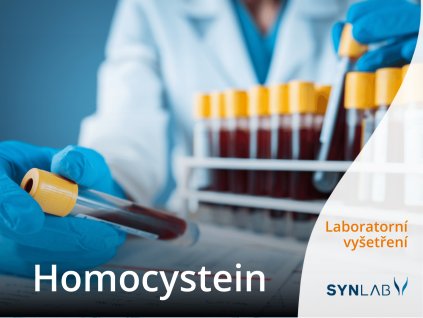 homocystein synlab