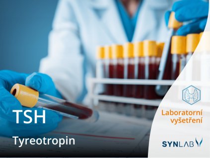 tsh tyreotropin synlab