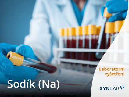laboratorní vyšetření sodík SYNLAB