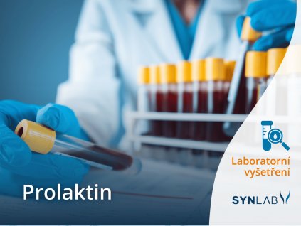 Prolaktin SYNLAB