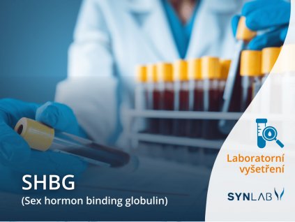 SHBG SYNLAB