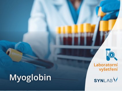Myoglobin SYNLAB