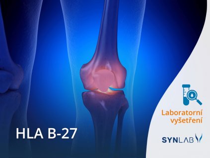 Vyšetření HLA B 27 SYNLAB