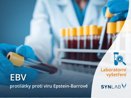 Vyšetření EBV SYNLAB