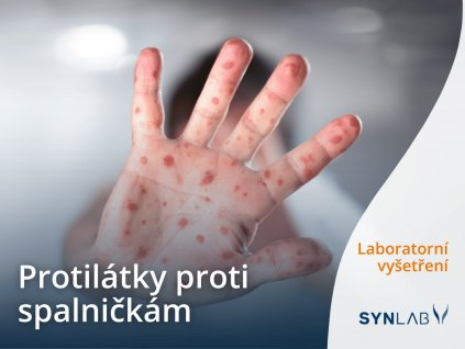 Test protilátek proti spalničkám Synlab